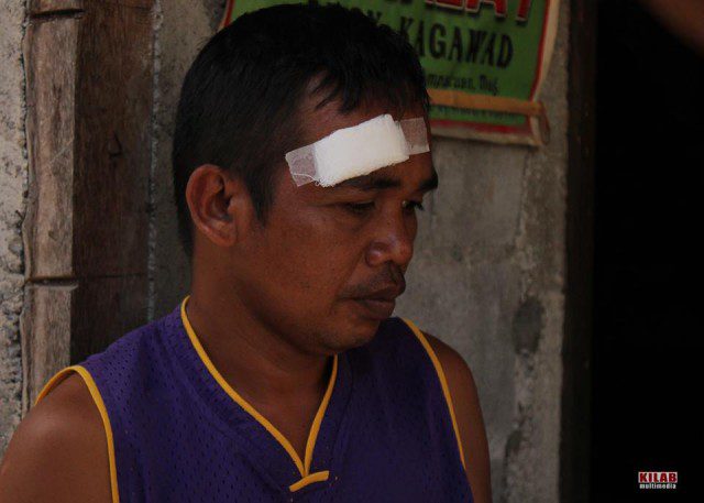 Boyong Unggla was grazed by a stray bullet in the head (Photo by Kilab Multimedia)