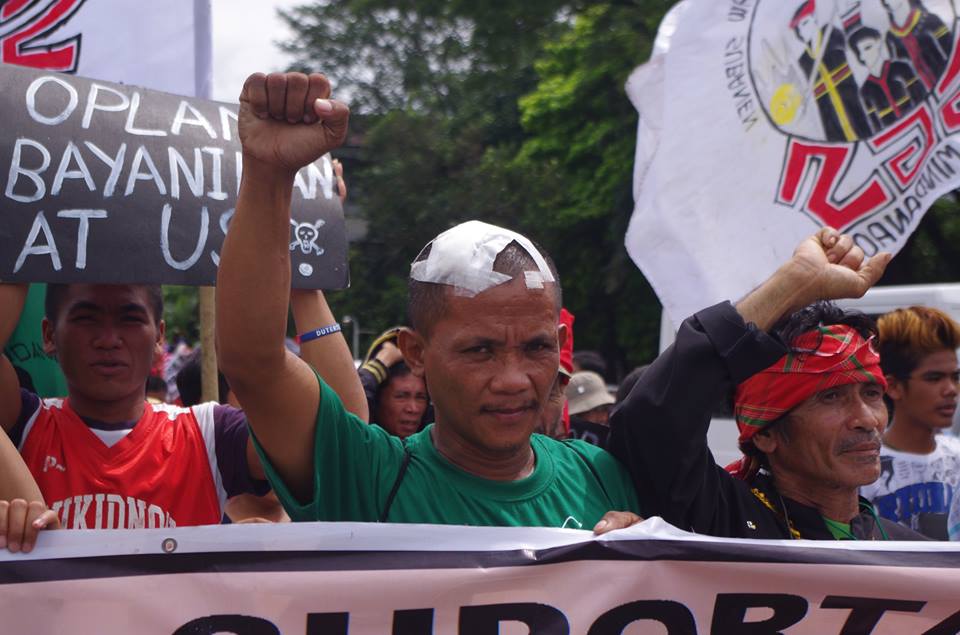 One of the injured protesters in the US embassy violent dispersal join the indignation rally in UP Diliman Oct. 20 (Photo by Fred Dabu/Bulatlat)