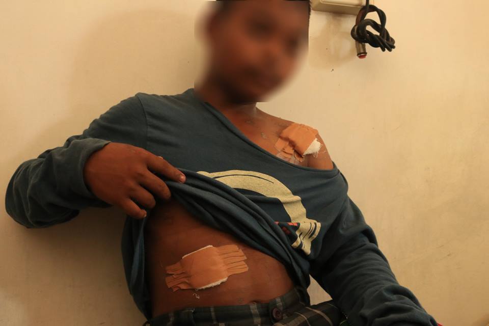 A resident wounded from the aerial strikes in Salat village, President Roxas, North Cotabato (Photo by Kilab Multimedia)